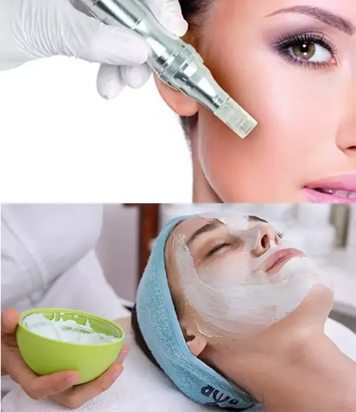 microneedling vs chemical peel