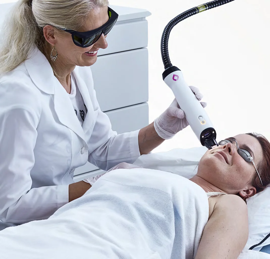 laser resurfacing