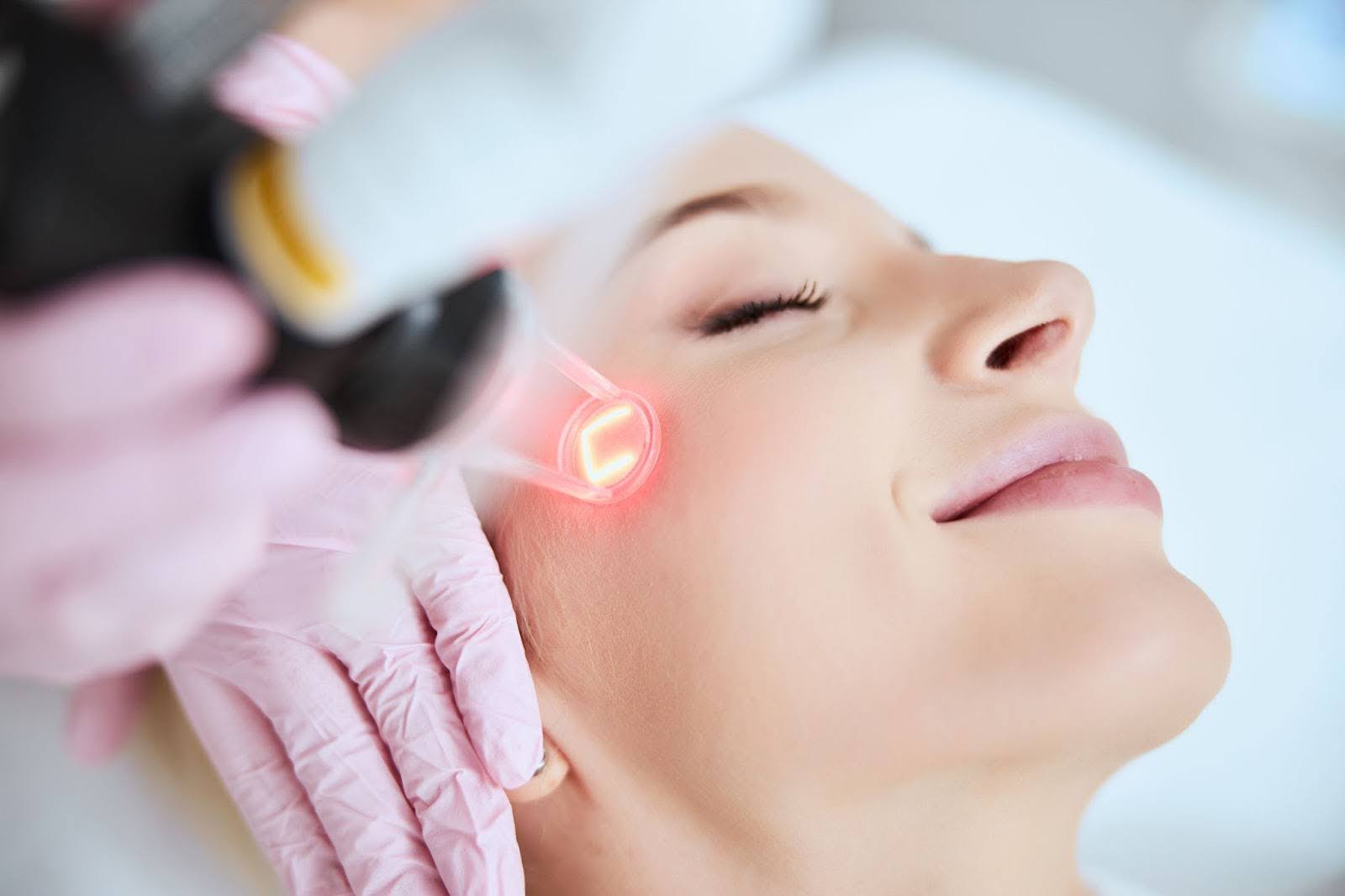 What You Need to Know About Laser Skin Resurfacing: Essential Insights