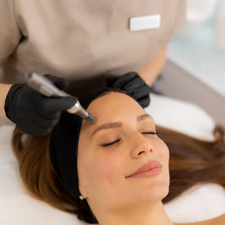 cosmetic microneedling dermatology cosmetic microneedling dermatology